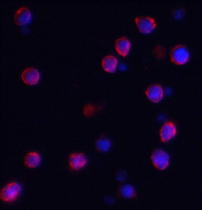 IQSEC1 Antibody in Immunocytochemistry (ICC/IF)