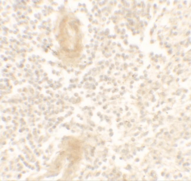 IL1F10 Antibody in Immunohistochemistry (Paraffin) (IHC (P))