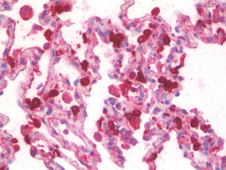 SFTPA1/SFTPA2 Antibody in Immunohistochemistry (Paraffin) (IHC (P))