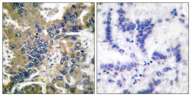 Caspase 1 (Cleaved Asp210) Antibody in Immunohistochemistry (Paraffin) (IHC (P))