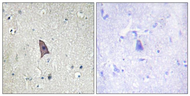 Phospho-TEK (Tyr1102) Antibody in Immunohistochemistry (Paraffin) (IHC (P))