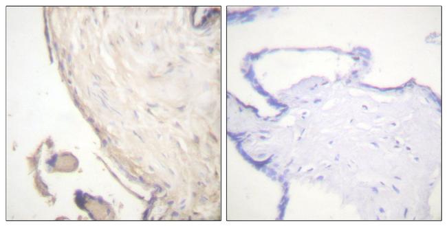 Phospho-B-Raf (Ser602) Antibody in Immunohistochemistry (Paraffin) (IHC (P))