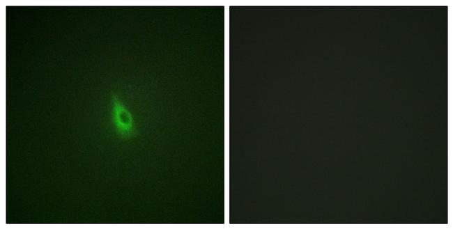 Phospho-IP3 Receptor 1 (Ser1588, Ser1598) Antibody in Immunocytochemistry (ICC/IF)