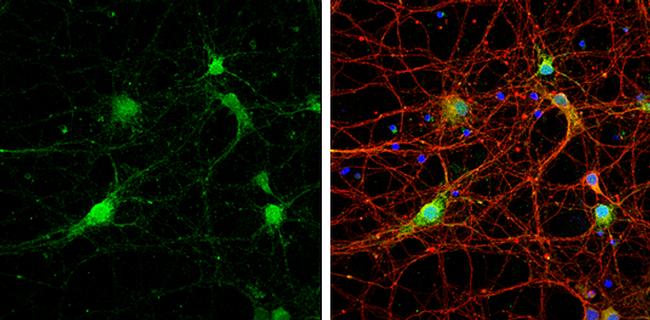 STX17 Antibody in Immunocytochemistry (ICC/IF)