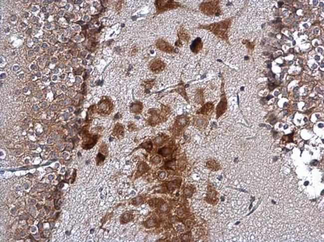 Ataxin 2 Antibody in Immunohistochemistry (Paraffin) (IHC (P))