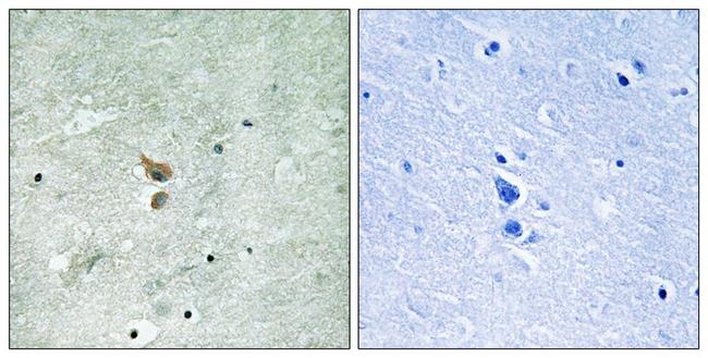 Phospho-RIP2 (Ser176) Antibody in Immunohistochemistry (Paraffin) (IHC (P))