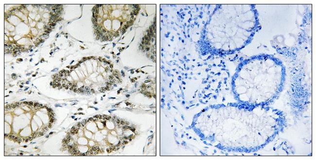 Phospho-ATR (Ser428) Antibody in Immunohistochemistry (Paraffin) (IHC (P))