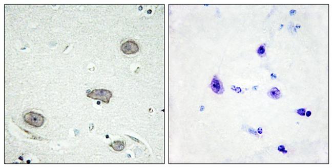 Phospho-CSF1R (Tyr809) Antibody in Immunohistochemistry (Paraffin) (IHC (P))