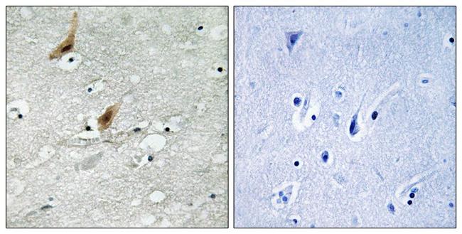 Phospho-MSK2 (Thr568) Antibody in Immunohistochemistry (Paraffin) (IHC (P))