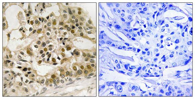 Phospho-Myb (Ser532) Antibody in Immunohistochemistry (Paraffin) (IHC (P))