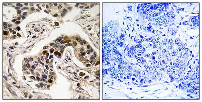 Phospho-NUDC (Ser326) Antibody in Immunohistochemistry (Paraffin) (IHC (P))