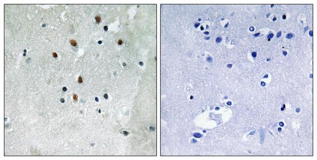 Phospho-SRF (Ser77) Antibody in Immunohistochemistry (Paraffin) (IHC (P))