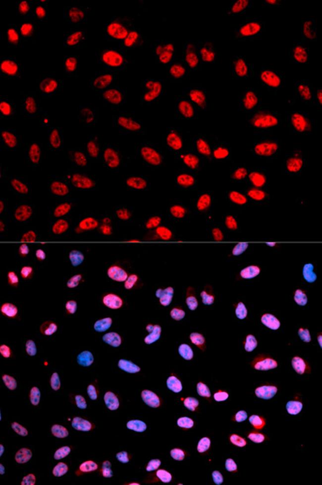 Phospho-Separase (Ser1126) Antibody in Immunocytochemistry (ICC/IF)