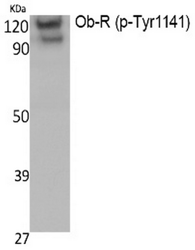 Phospho-Leptin Receptor (Tyr1141) Antibody in Western Blot (WB)