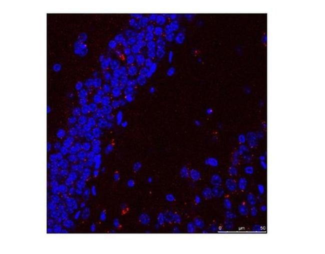 HSPA9 Antibody in Immunohistochemistry (IHC)