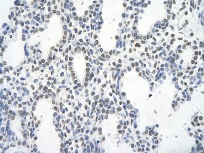 Fra1 Antibody in Immunohistochemistry (Paraffin) (IHC (P))