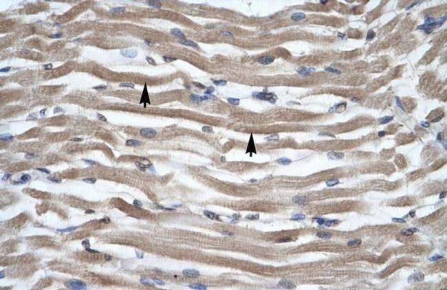 DLX2 Antibody in Immunohistochemistry (IHC)