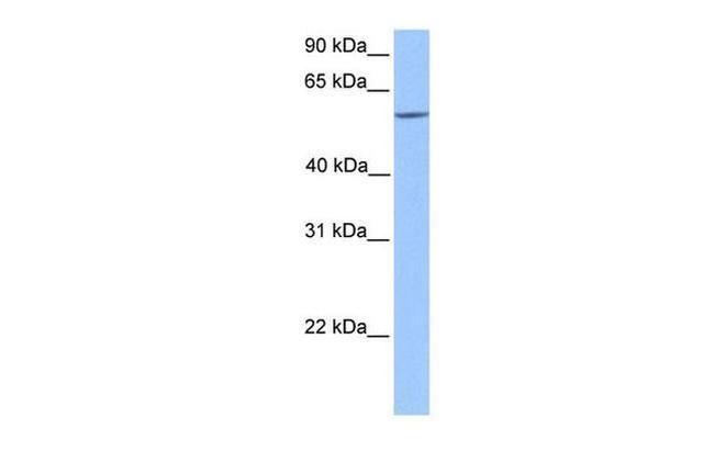 ERF Antibody in Western Blot (WB)