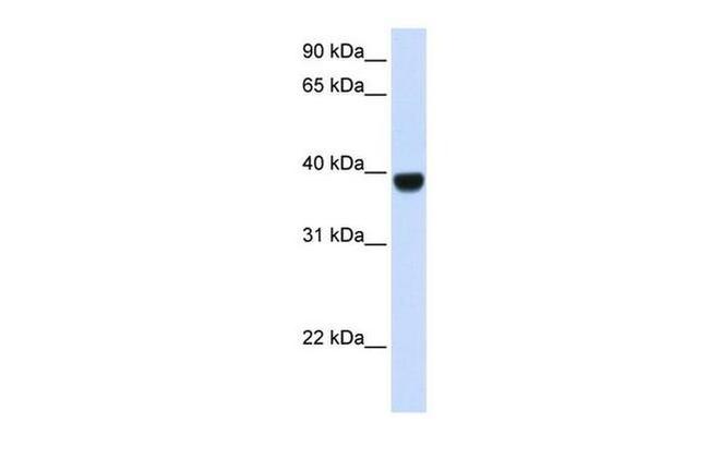 FOXE1 Antibody in Western Blot (WB)