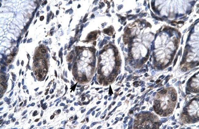 HCLS1 Antibody in Immunohistochemistry (Paraffin) (IHC (P))