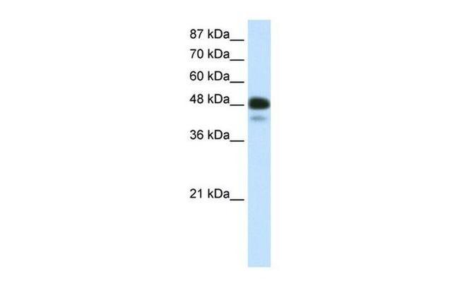 NeuroD2 Antibody in Western Blot (WB)