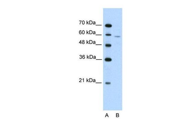 IRX4 Antibody in Western Blot (WB)