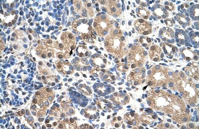 PBX3 Antibody in Immunohistochemistry (IHC)