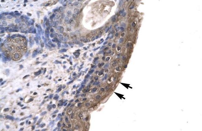 RNF12 Antibody in Immunohistochemistry (IHC)