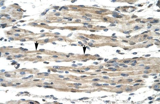 FOXL1 Antibody in Immunohistochemistry (IHC)