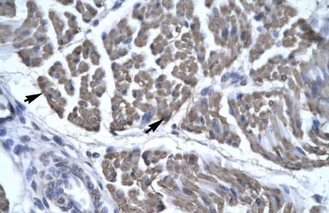 EYA3 Antibody in Immunohistochemistry (IHC)