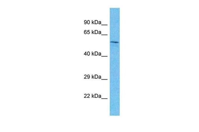 SIX4 Antibody in Western Blot (WB)