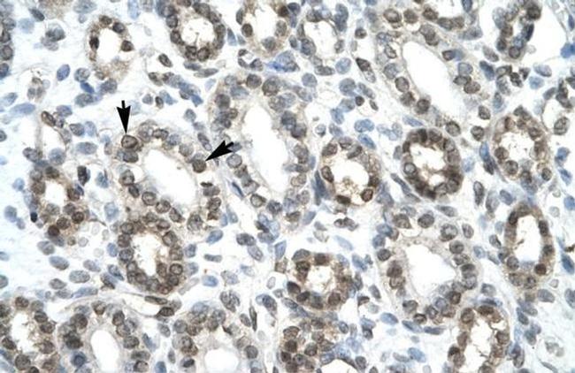 HEY1 Antibody in Immunohistochemistry (Paraffin) (IHC (P))