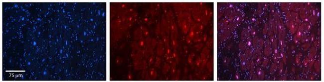 HIPK2 Antibody in Immunohistochemistry (Paraffin) (IHC (P))