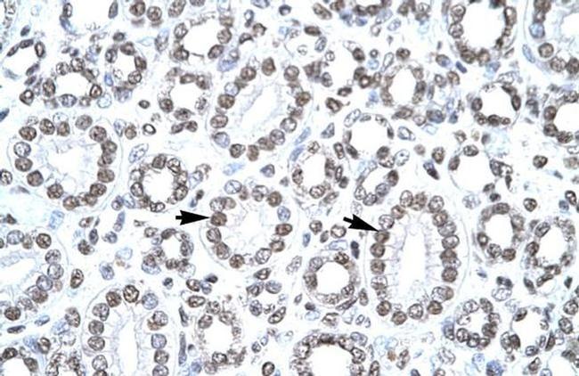 CITED1 Antibody in Immunohistochemistry (IHC)