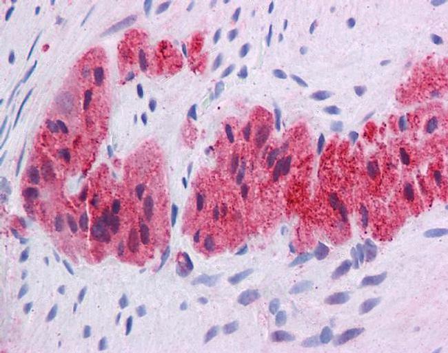 KLF2 Antibody in Immunohistochemistry (IHC)