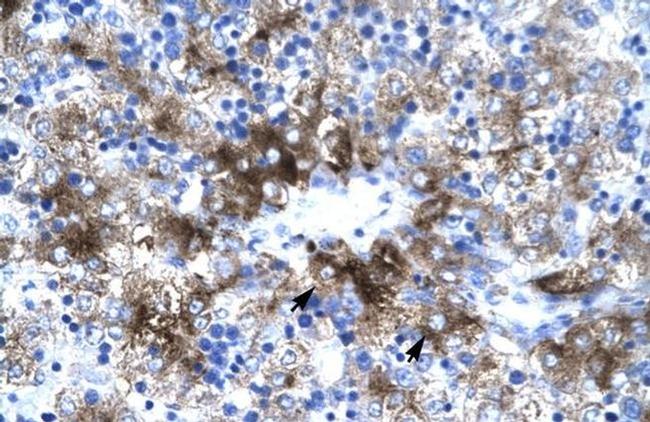 PIAS3 Antibody in Immunohistochemistry (IHC)