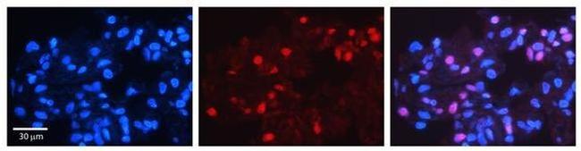 MAD4 Antibody in Immunohistochemistry (Paraffin) (IHC (P))