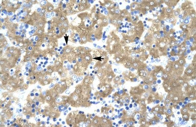 ACAT2 Antibody in Immunohistochemistry (IHC)