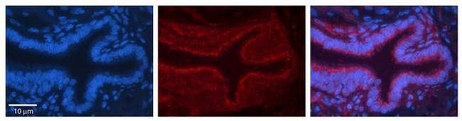 ME1 Antibody in Immunohistochemistry (Paraffin) (IHC (P))