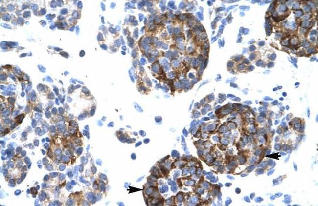 BarX1 Antibody in Immunohistochemistry (IHC)