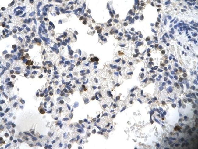 PCYOX1 Antibody in Immunohistochemistry (Paraffin) (IHC (P))