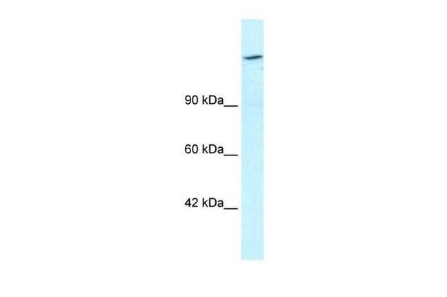 ARID4A Antibody in Western Blot (WB)