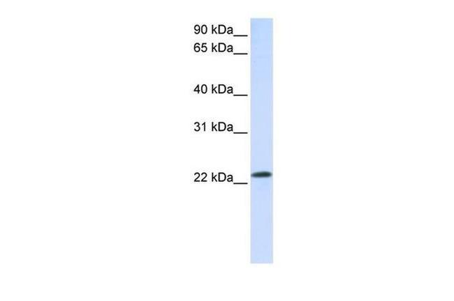 RAB18 Antibody in Western Blot (WB)