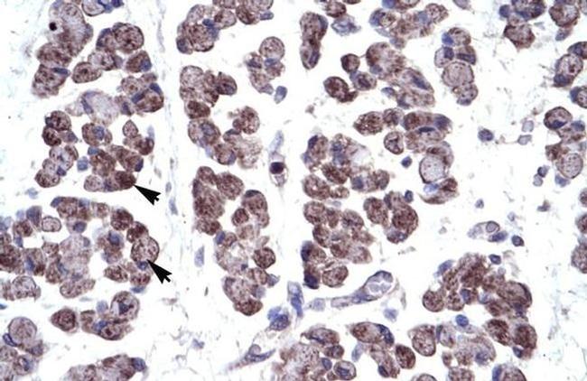 TBX20 Antibody in Immunohistochemistry (IHC)