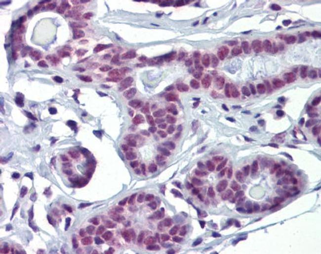 SOX4 Antibody in Immunohistochemistry (IHC)