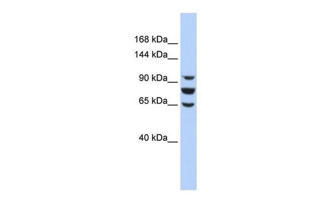 EPC1 Antibody in Western Blot (WB)