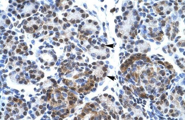 SPT5 Antibody in Immunohistochemistry (Paraffin) (IHC (P))