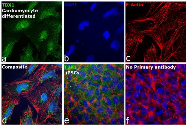 TBX1 Antibody in Immunocytochemistry (ICC/IF)