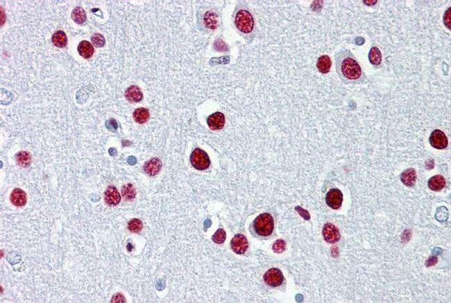 TUB Antibody in Immunohistochemistry (IHC)