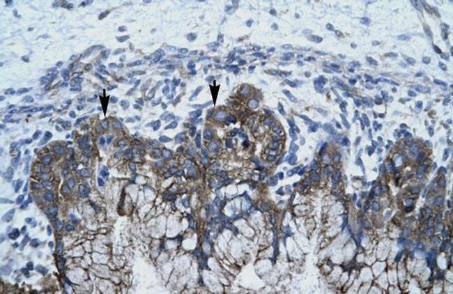 APOBEC3G Antibody in Immunohistochemistry (IHC)